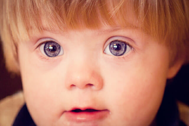 2012/34 – Eyes